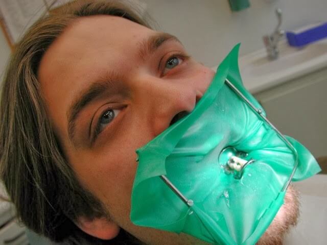 Zdjęcie przedstawia zabezpieczenie u dentysty: kofedam przy wierceniu plomb - blokowana toksyna